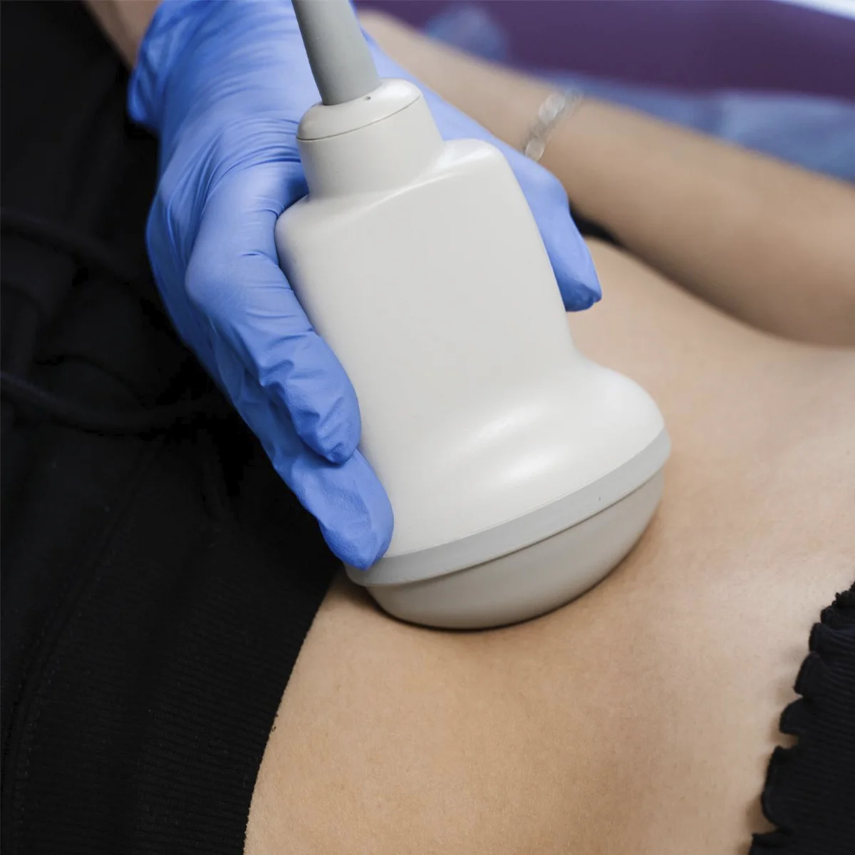 SCIZER Refinamento Corporal